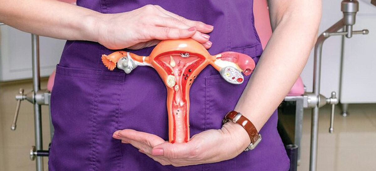 Adenomyosis and Uterine Fibroids – How Embolisation Helps