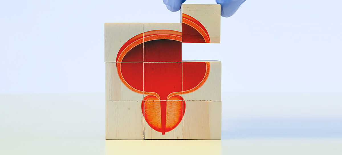 Understanding Enlarged Prostate and Parkinsonism: A Common Concern for Men