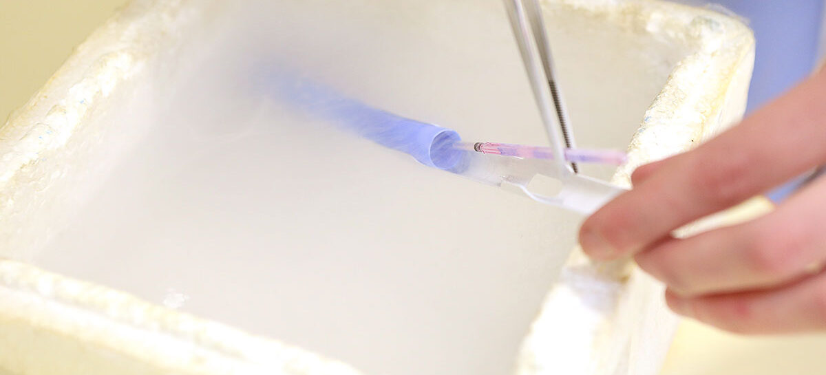 Preserving Fertility – Techniques for Future Family Planning
