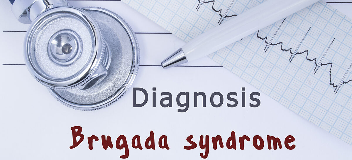 Brugada Syndrome – A Rare Genetic Heart Condition