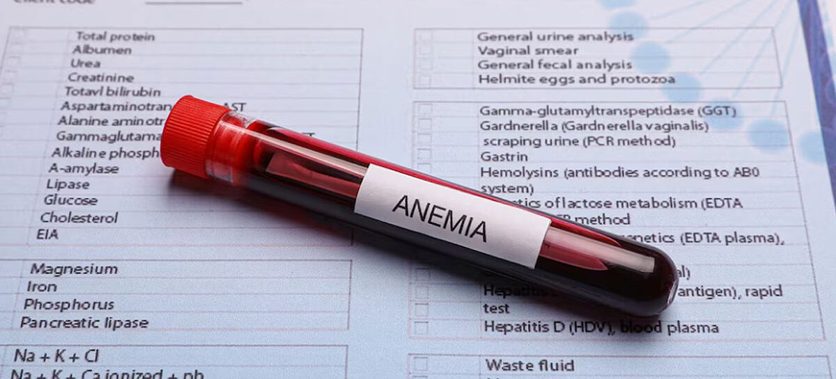 Tips to Tackle Anaemia