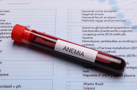 Tips to Tackle Anaemia