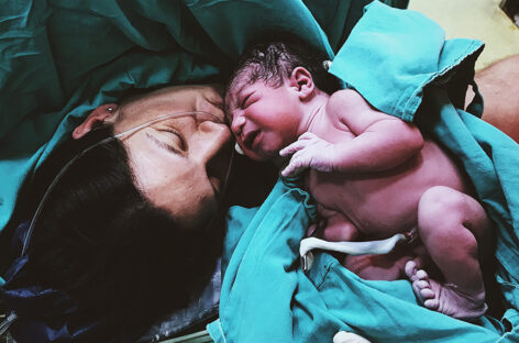 C-section vs. Natural Delivery – What to keep in mind for a safe birthing experience