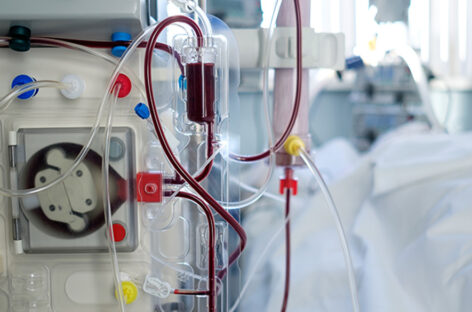 Permanent Catheter Placement for Dialysis Patients