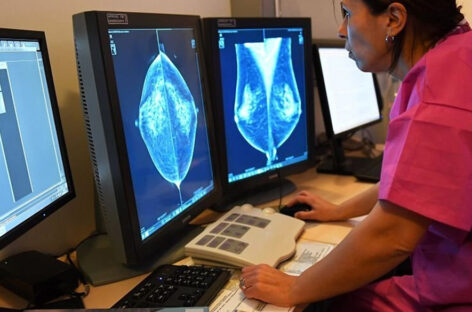 Top 5 Cancer Screenings Everyone Over 40 Should Consider