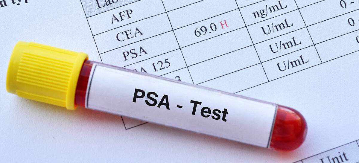 Prostate Health – Understanding Enlargement, Cancer Symptoms and PSA Tests