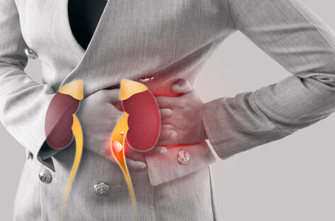 The Hot Truth About Kidney Stones: Summer Risks and Remedies