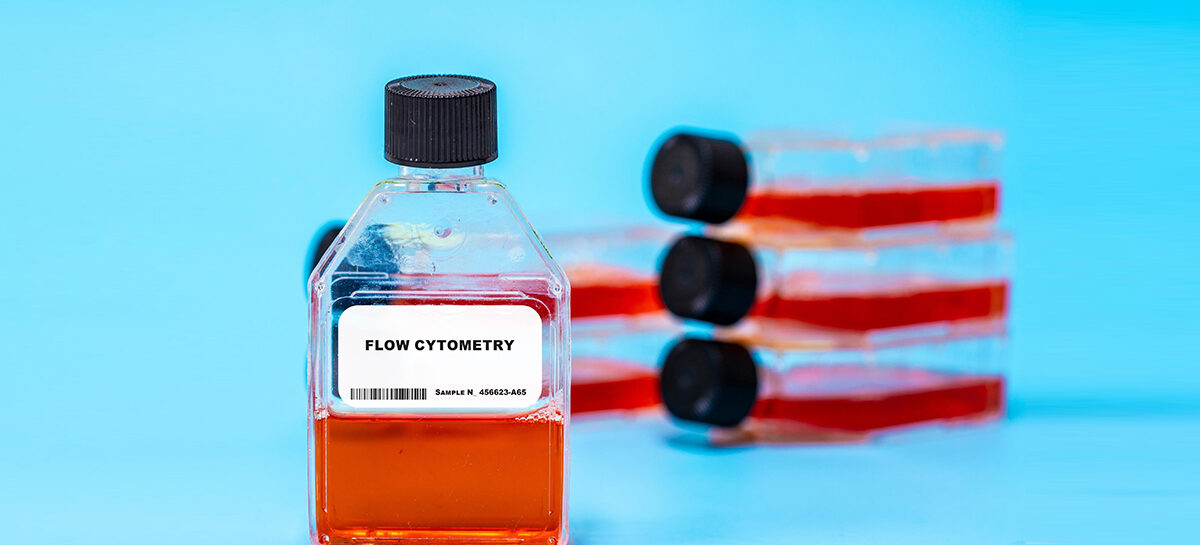 Urinary Fluorescence Flow Cytometry