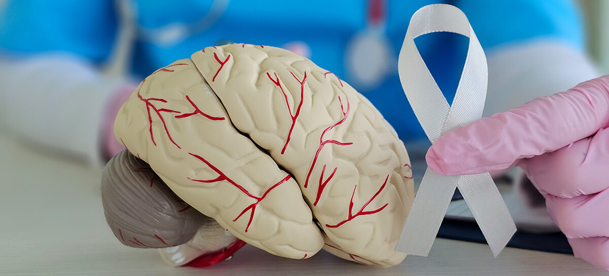 Brain Tumour: Causes, Types, and Symptoms Explained
