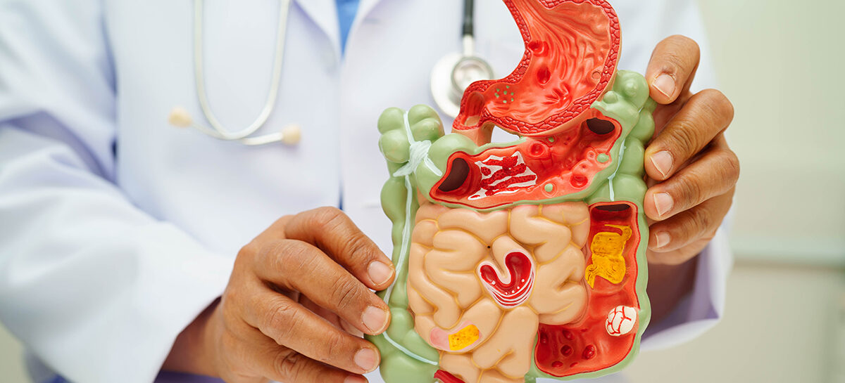 Treating Gastrointestinal Stromal Tumours
