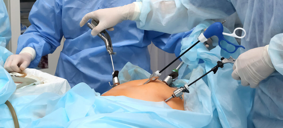 A Big Leap Without the Big Cut: Laparoscopic Surgery, a Boon in Gastroenterology