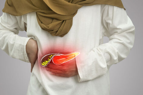 Gallstones Unveiled: All You Need to Know About this Silent Threat