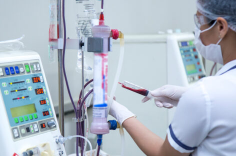 Dialysis: A second chance at life when kidneys fail