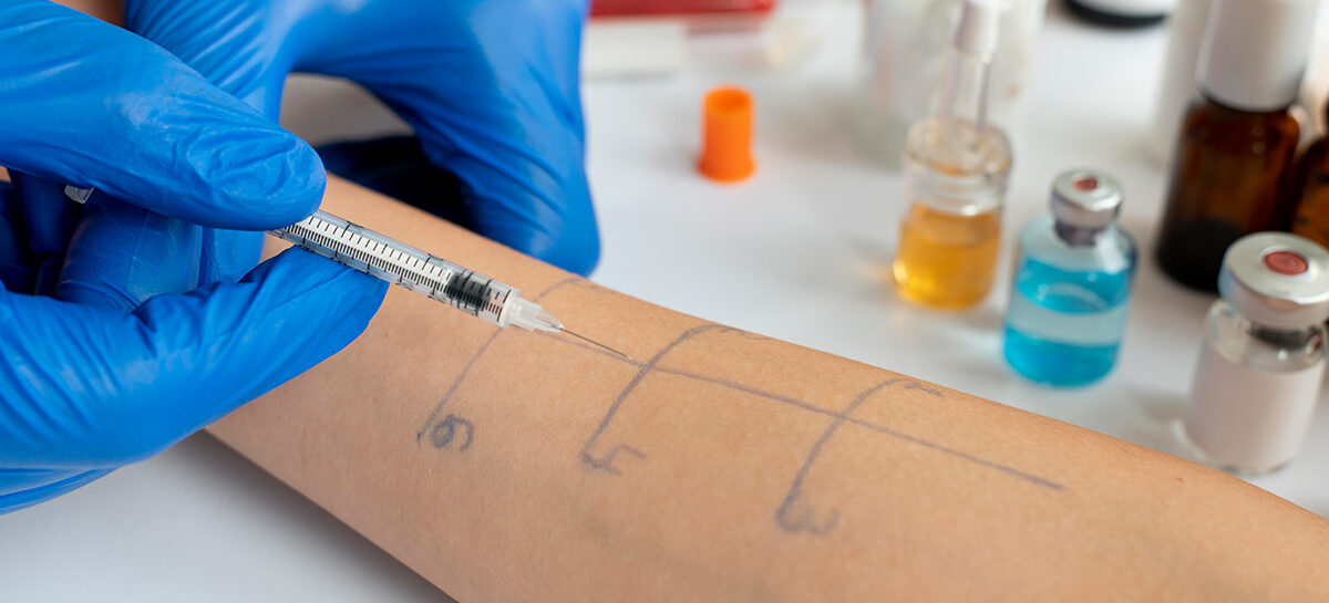 How can Allergy Testing help me?