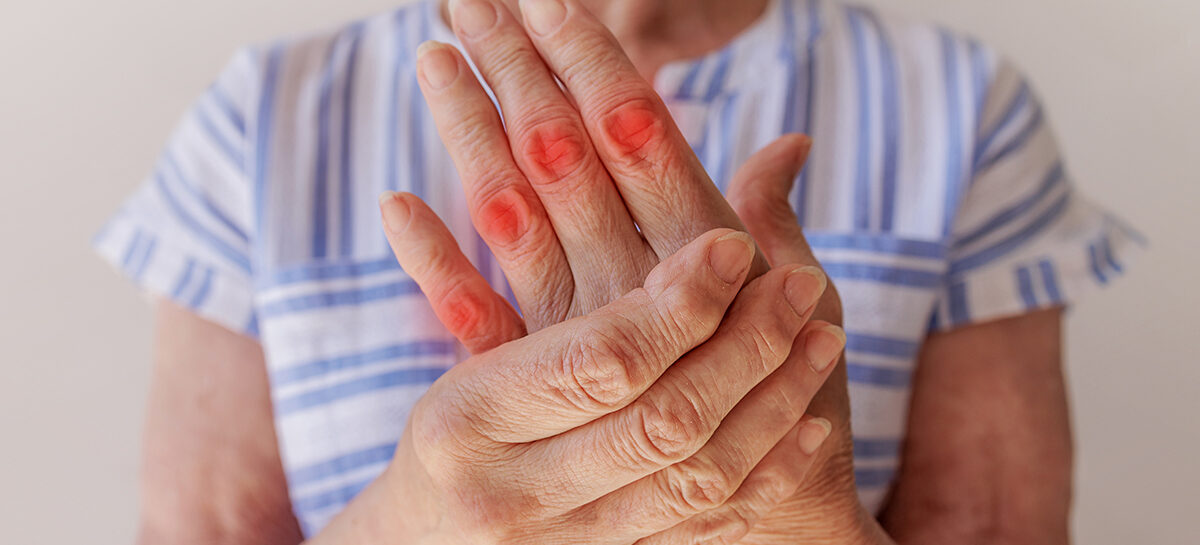 Tips to Manage Arthritis in your Hands