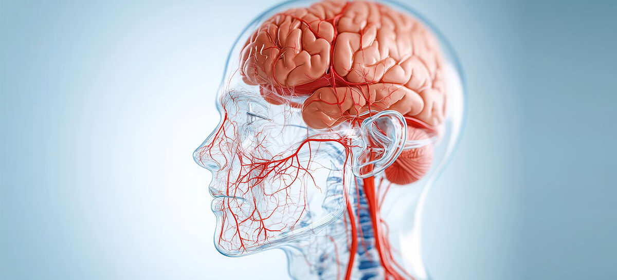 Moya Moya Disease: The Silent Traffic Jam Inside the Brain