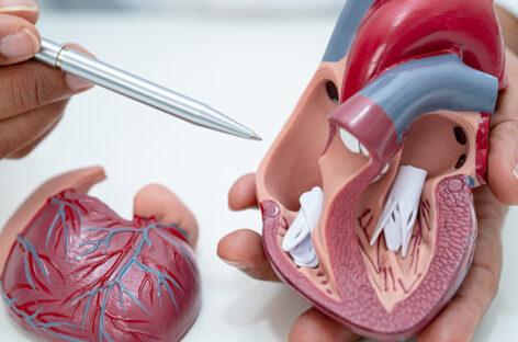 Why Choose Mitral Valve Repair Over Replacement?