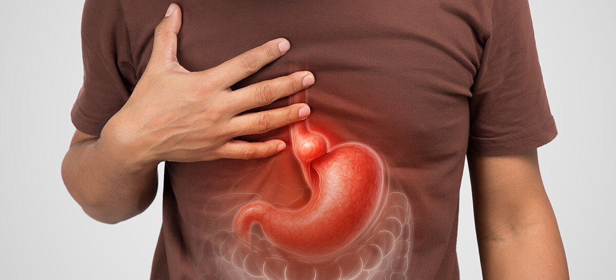 Hiatal Hernia