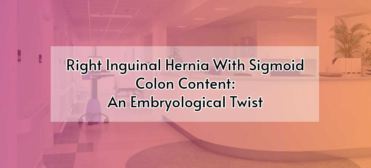 Right Inguinal Hernia With Sigmoid Colon Content: An Embryological Twist