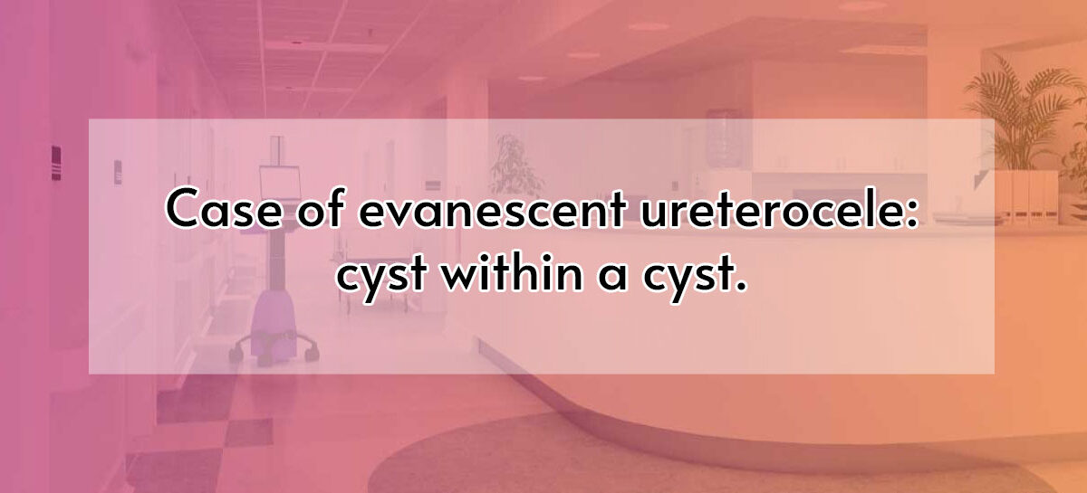 Case of evanescent ureterocele:  cyst within a cyst.
