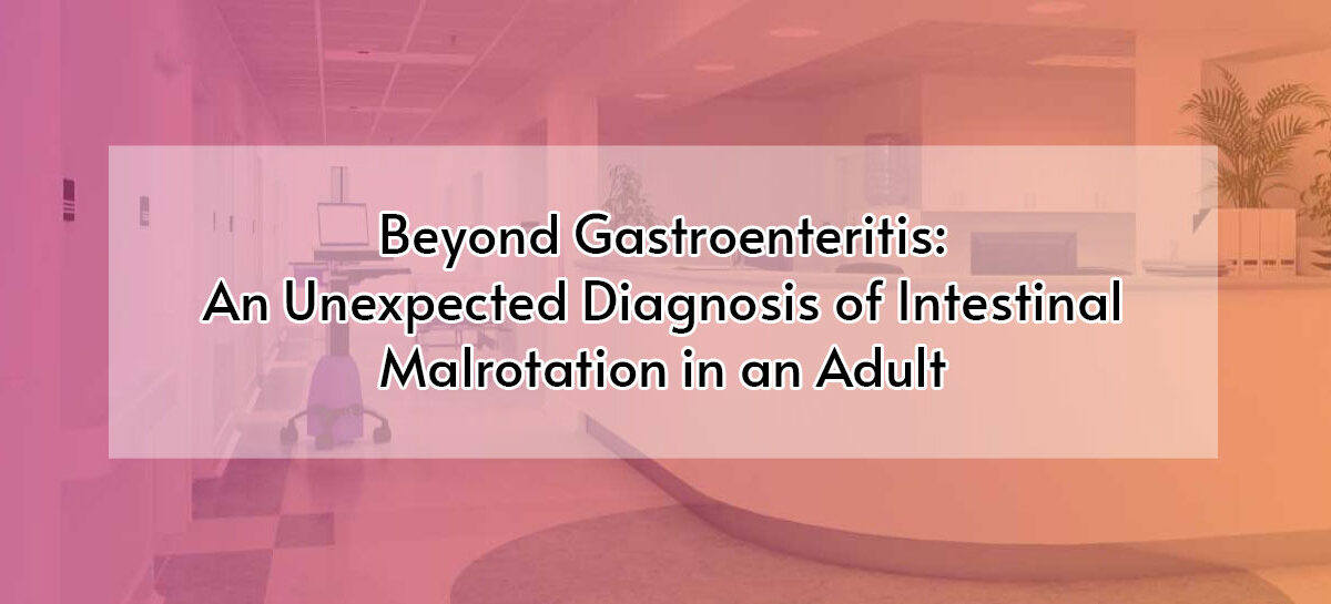 Beyond Gastroenteritis: An Unexpected Diagnosis of Intestinal Malrotation in an Adult