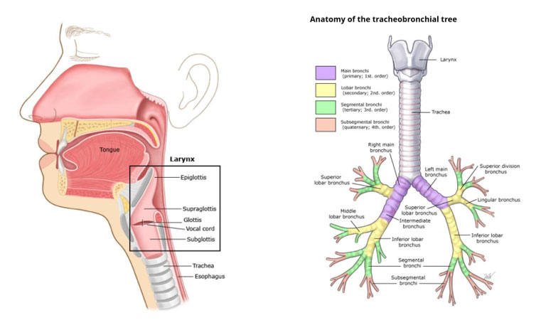 Post-Intubation Subglottic Stenosis: A Case Report and Review of Literature