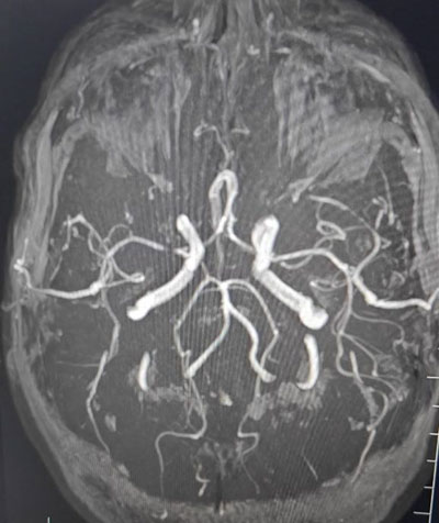 Hospital Course 