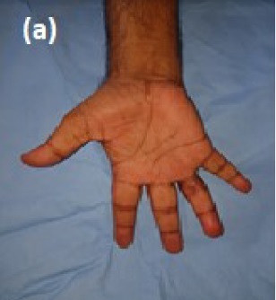 upperlimb-fig-6a