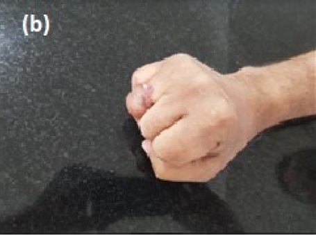 upperlimb-fig-6b