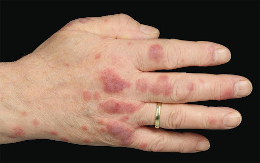 Diagnostic-image