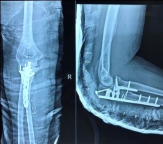 orthopaedics-case-series-7