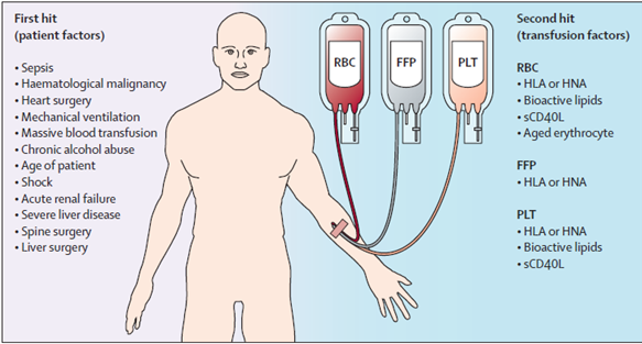 transfusion-related-acute-lung-injury