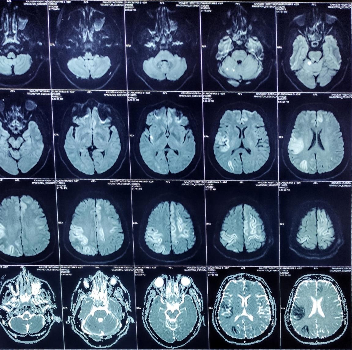 MRI-Brain-2