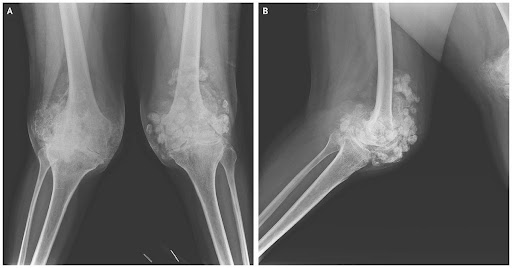 DIAGNOSTIC-IMAGE