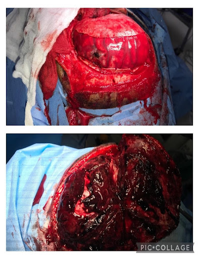 challenges-in-neuroanaesthesia-and-neurointensive-care-1