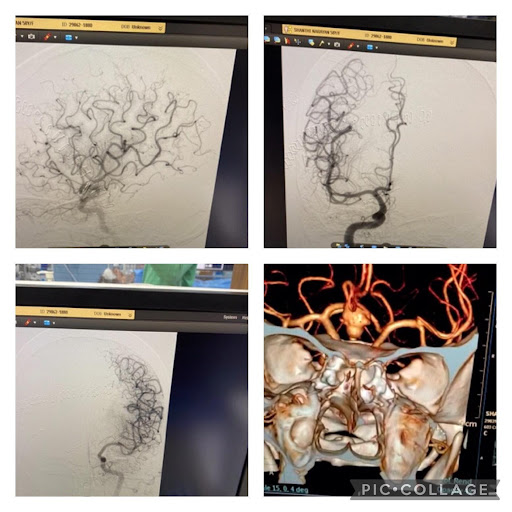 challenges-in-neuroanaesthesia-and-neurointensive-care-5