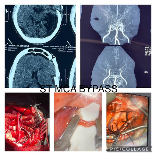 challenges-in-neuroanaesthesia-and-neurointensive-care-7