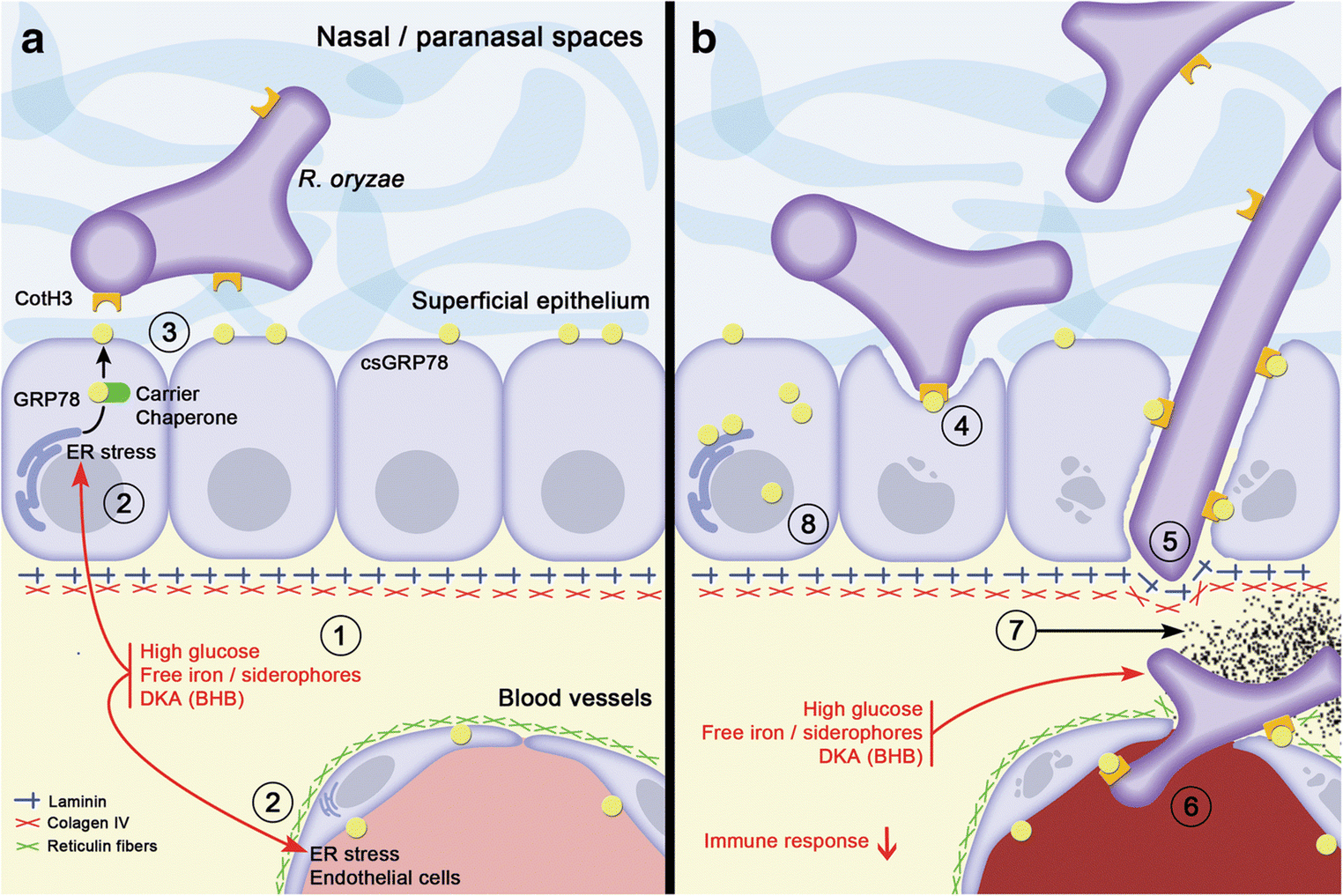 Mucormycosis-6