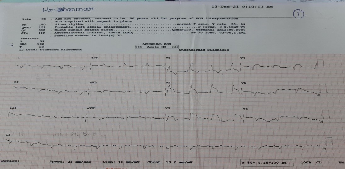 Arrival-ECG