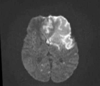 Axial-MRI-brain