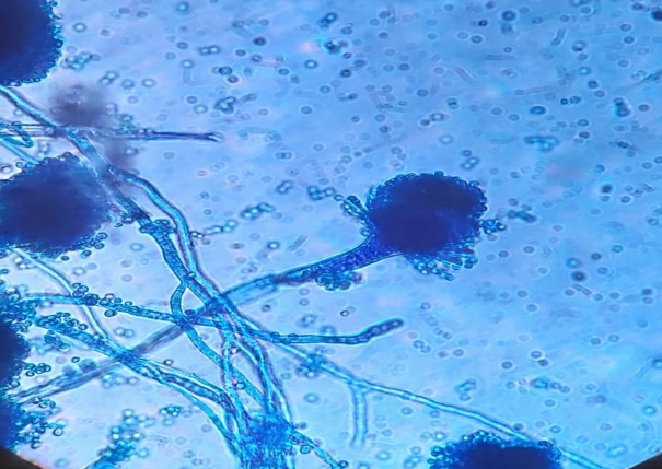 Microscopic-View
