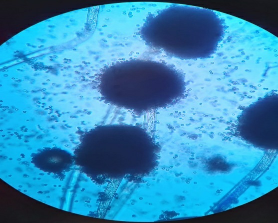Rhizopus