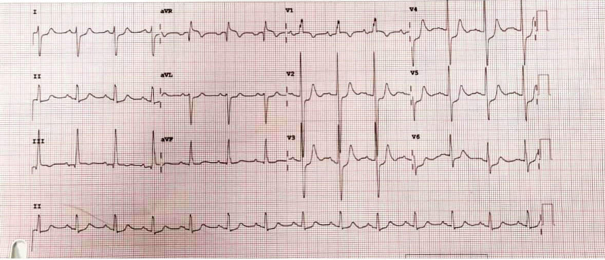 A-Racing-Heart-Beat-2