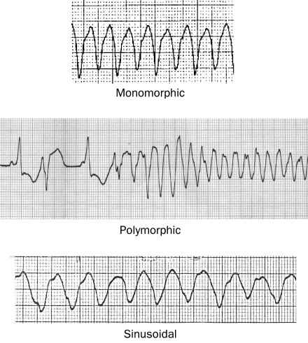 A-Racing-Heart-Beat-3