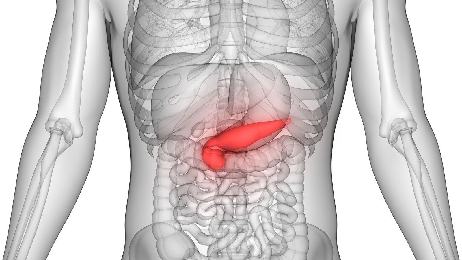 Hypertriglyceridemia-1