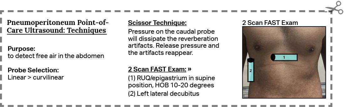 Pneumoperitoneum-6