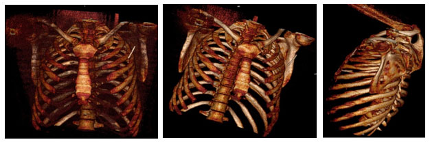 CTVS-ICU-2