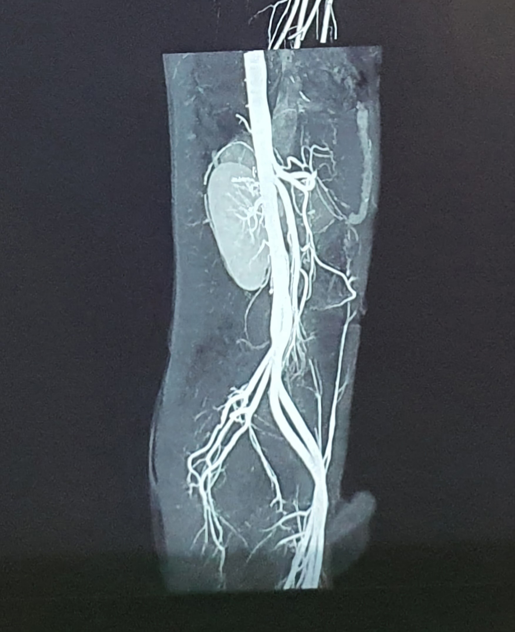 SMA-4