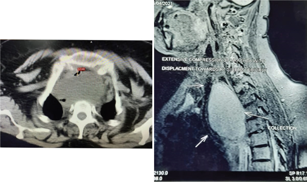 Dynamic-examination-of-airway-1