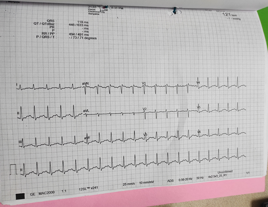 ER-3